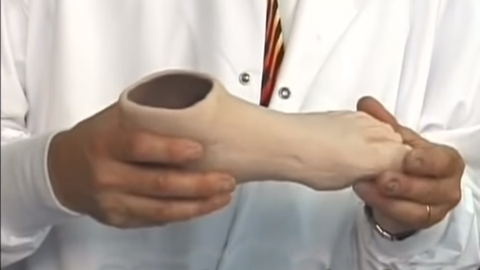 硅胶部分脚假体的定制制造